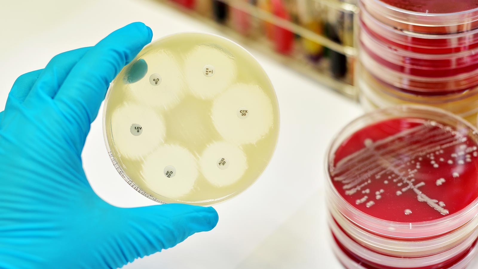 Problema de salud pública: uso de antibióticos en animales